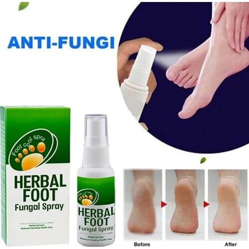 30ml Herb Foot Skin Treatment Spray Anti-fungal Infections Onychomycosis Paronychia Foot Care Spray Foot Fungus Treatment Liquid
