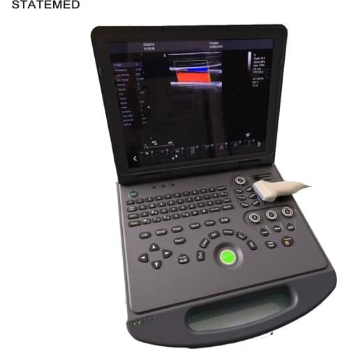 3D/4D Portable color doppler ultrasound Machine Ultrasound Scanner