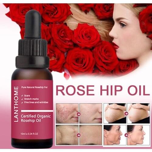 10 ml Pure Organic Rosehip Oil Essense Antioxidantfor Scars Fine Lines Wrinkles Stretch Marks Improve Skin Elasticity Firmness