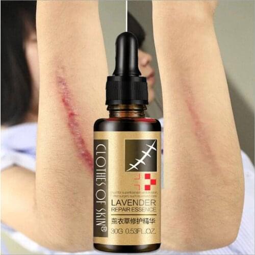 30g Lavender Essence Scar Repair Skin Essential Oil Natural Pure Remove Ance Burn Strentch Marks Scar Removal