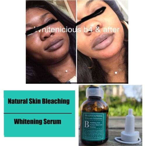 Free Shipping Dark Skin Bleaching Cream Whitening Lightening Dark Spot Max Strength SERUM