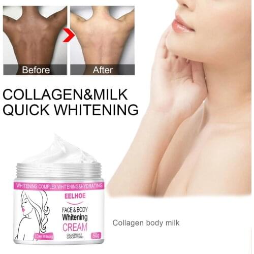 10g/ 20g/ 50g Whitening Cream For Dark Skin Bleaching Mosturizing Remove Marks Skin Care Elbows Chests Knees Whiten for Beauty