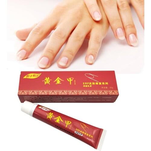 Chinese Medicine Herbs Toe Nail Fungus Treatment Anti Fungal Nail Infection Essence Nail Treatment Removal Nail Care Lotion