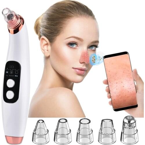 Black Dots Vacuum Blackhead Remover Pore Cleaner T Zone Pore Acne Pimple Removal Suction with WiFi Wireless Camera Skin Care