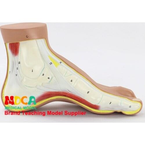 MJRJ004 model of arch foot foot arch foot foot joint anatomical model medical teaching