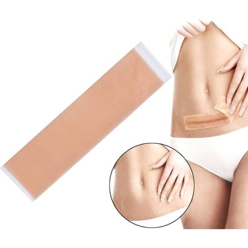 Silicone Scar Removal Patch Remove Trauma Burn Scar Sheet Skin Repair Scar Removal Therapy Patch for Acne Scar Treatment 2 Size