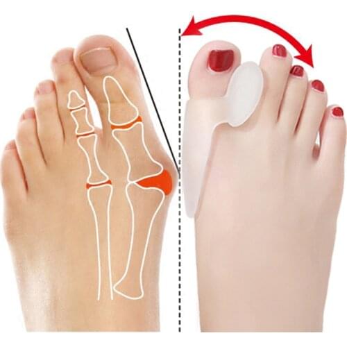 1pair Hallux Valgus Broadhurst Pad Remedical Bone Thumb Silica Gel Daily Use Silicone Foot Care Sets Toe Bunion Protector