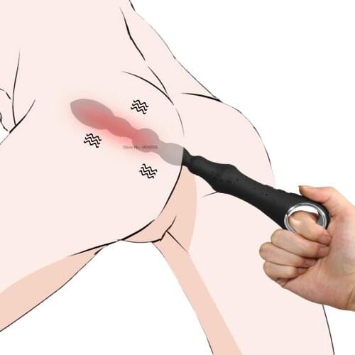Nc Anal Beads