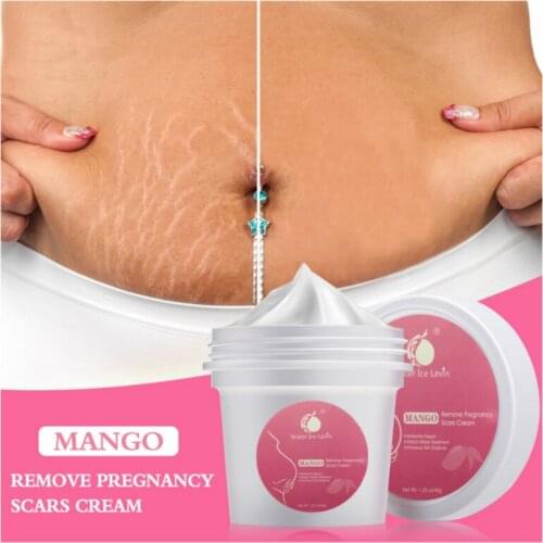 Powerful Stretch Marks Pregnancy Scar Removal Maternity Skin Body Repair Cream Smooth Skin Cream Remove Scar Care Postpartum