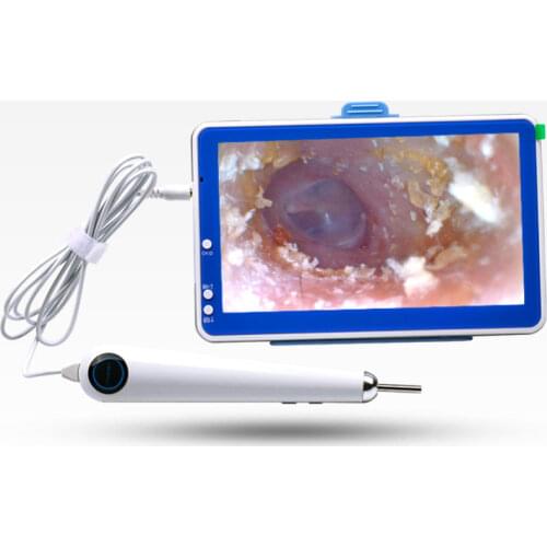 Digital Otoscope 3.9mm ENT endoscope 7 Inch HD Screen visual otoscope ear Cleaning endoscope Ear Scope Camera Can Record Video