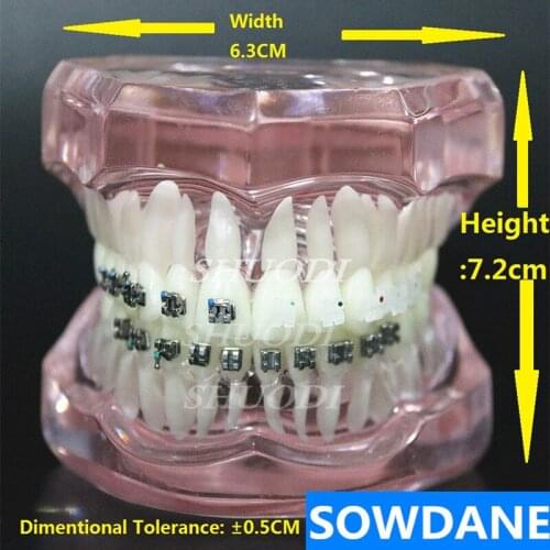 Dental Orthodontic Model Patients Communication 4 kinds Brackets with Ceramic Bracket Metal Self Ligating