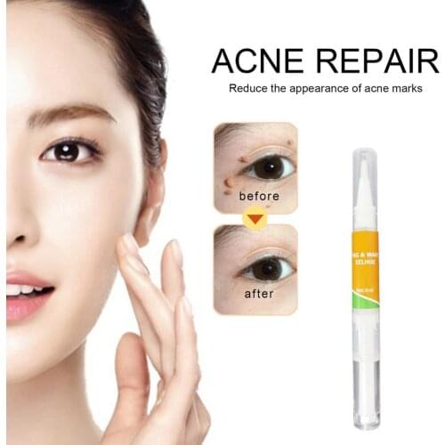 Point Mole Pen Removal Of Nevus Planus Care Repair Solution No Trace High Performance Penetration Nevus Removal Tool