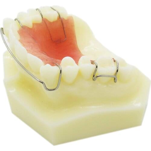 Dental Orthodontic demonstration Model Hawley Retainer Model M3007