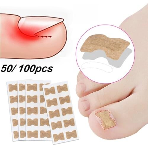 Ingrown Toenail Corrector Sticker Paronychia Treatment Fixer Recover Corrector Pedicure Foot Toe Nail Care Tool Elastic Patch