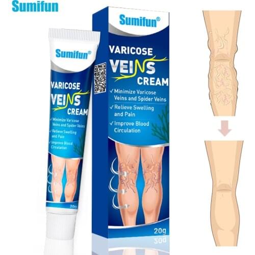 1Box Varicose Veins Treatment Cream Vasculitis Phlebitis Spider Ointment Varicosity Angiitis Removal Pain Relief Medical Plaster