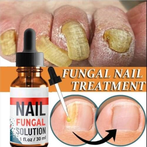 Nail Repair Solutions Brighten Repair Nourish Toenail Fingernail Nail Care Liquid SK88