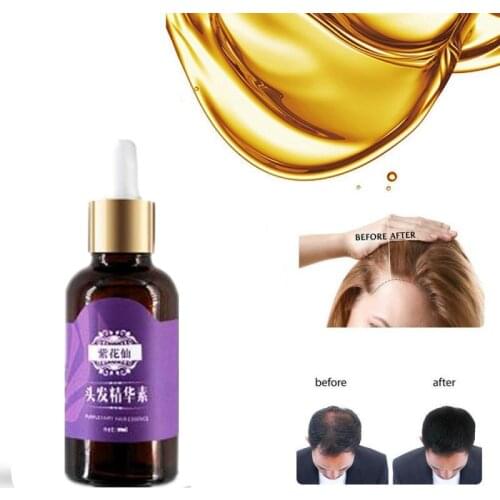 Ginger Fast Hair Growth Serum Essential Oil Anti Preventing Hair Lose Liquid Damaged Hair Repair Growing Dropship