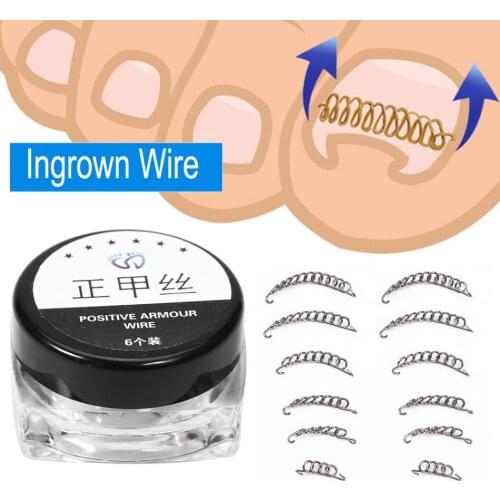 12Pcs/Box Ingrown Toenail Correction Tool 6 Sizes Ingrown Corrector Fixer Wire Pedicure Paronychia Nail Recover Foot Care Tools