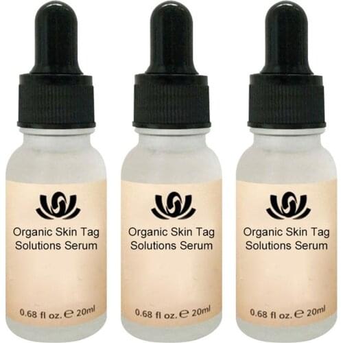 20ML 1PCS Mole & Skin Tag Repair Solution Serum Painless Mole Skin Dark Spot Repair Face Body Wart Tag Freckle Repair Cream Oil