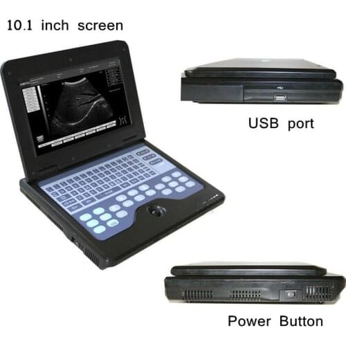 Laptop Digital 3d 4d Color Doppler Portable Medical Ultrasound Machine Price