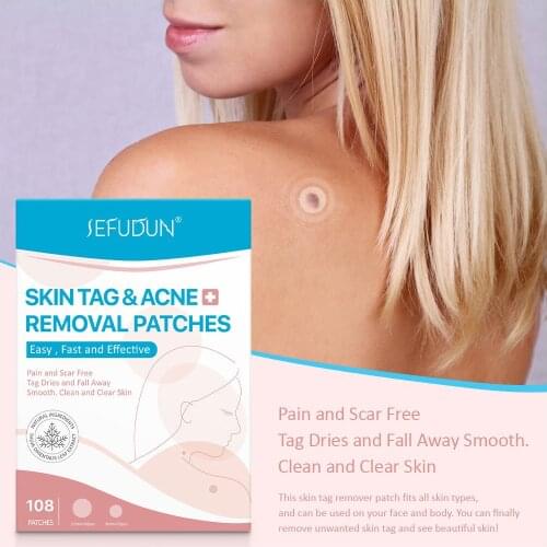 108pcs Skin Tag Remover Warts Remover Patch Wart Treatment Cream Herbal Extract Foot Corn Plaster Acne Warts Ointment