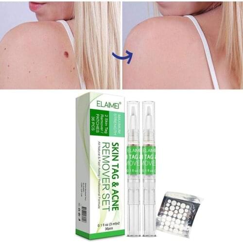 2pcs to remove wart pen corn meat thorn wart stick faded mole spots reduction 36 plaster body wart mark skin fragment mark I4N4