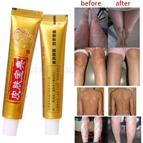 Natural Chinese Medicine Herbal Anti Bacteria Cream Psoriasis Eczema Ointment Treatment Drop Shipping