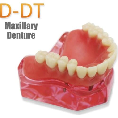 D-DT(Mixllary) Dental Study Teaching Model Dental Impant Standard Model Removable Teeth ADULT Child Model Dentist Communication