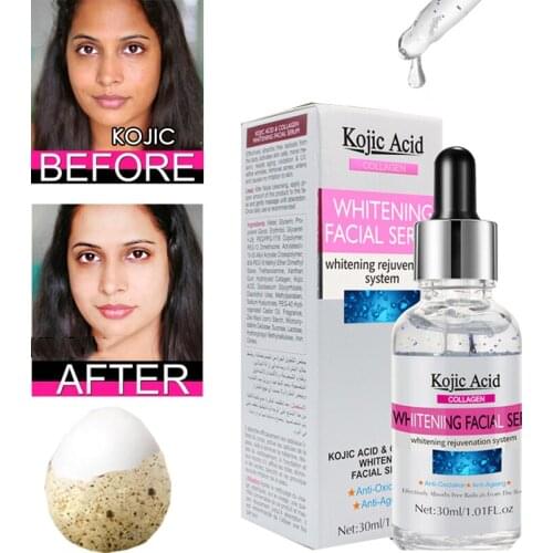 30ml Kojic Acid Facial Serum Whitening Brightening Moisturizing Improve Roughness Lighten Spots Hyaluronic Acid Facial Essence