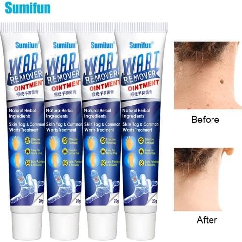 Sumifun 3/4pcs Warts Remover Skin Tag Remover Cream Antibacterial Ointment Foot Care Corn Plaster Cream Thorn Pain Relief