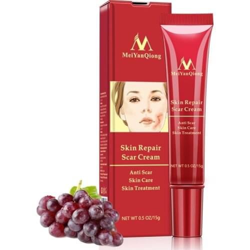 Mild Womens Smooth Body Skin Cream For Stretch Marks Scar Removal Skin Treat Blackhead Whitening Cream Skin Repair Face Creams
