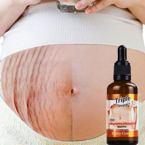 50ML Stretch Marks Remover Essential Oil Skin Care Treatment Cream For Stretch Mark Maternity Slackline For Pregnant Oils