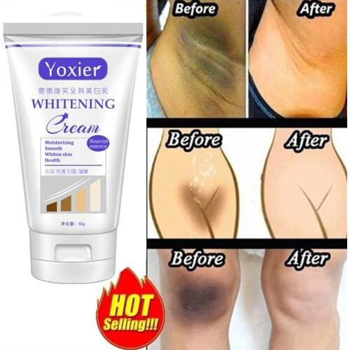 Yoxier Whitening Cream Moisturizing Nourish Repair Improve Arm Armpit Ankles Elbow Knee Body Dull Brighten Arbutin Skin Care 50g