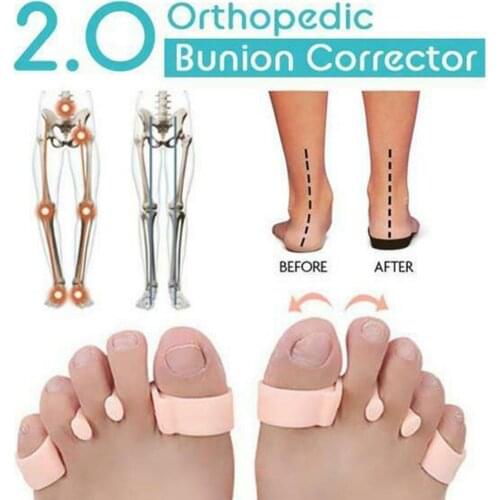 1 Pair Unisex Feet Orthopedic Bunion Corrector Overlapping Toes Separator Protector Foot Pain Relief Hallux Pedicure Foot Care