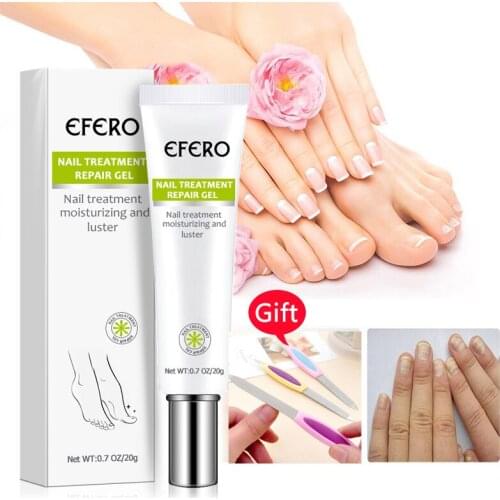 Feet Toe Care Treatment Foot Nail Fungus Removal Gel Anti Infection Paronychia Onychomycosis Fungal Nail Repair Essence Serum