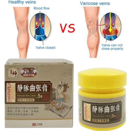 Yoxier Cream For Varicose Veins