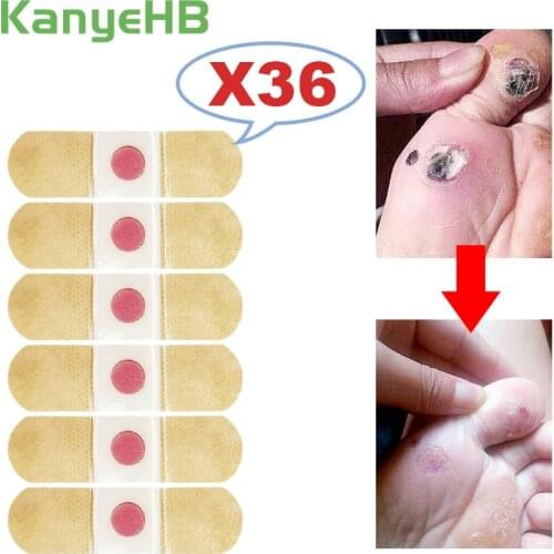 36pcs Corn Removal Pads Foot Care Sticker Medical Patch Warts Thorn Curative Patches Effective Remove Calluses Plaster A295