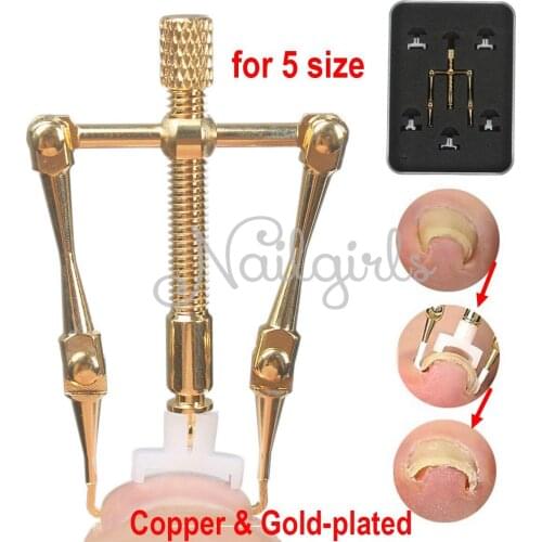100% copper Ingrown Toenails foot Toe nail Correction Tool Manicure Clipper Pedicure Fixer file Recover for feet orthotic bunion