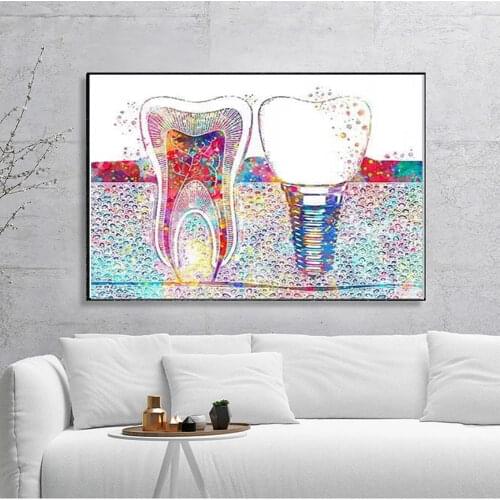Dental Art Posters Tooth Implant Canvas Painting Dental Hygienist Wall Prints Pictures Clinic Decor Cuadros Decoration No Frame