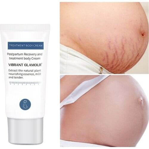 Remove Stretch Marks Repair Cream Maternity Skin Repair Scars Obesity Lines