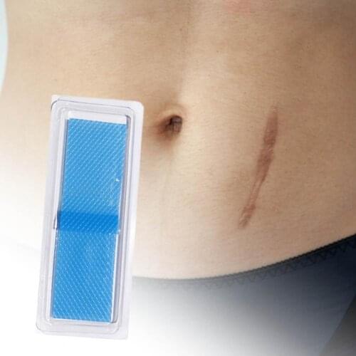 Therapy Patch Waterproof Restore Skin Skin Repair Caesarean Section Surgery Silicone Scar Sheets for Skin