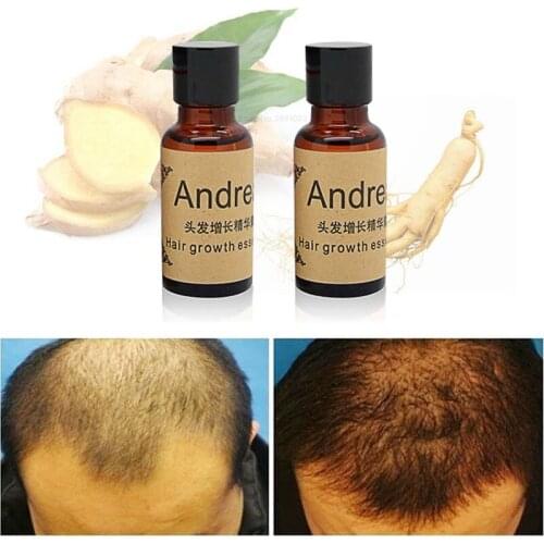 Andrea Hair Growth Anti Hair Loss Liquid 20ml Dense Hair Fast Sunburst Hair Growth Grow Alopecia Essence Oil 2017 Hot Selling