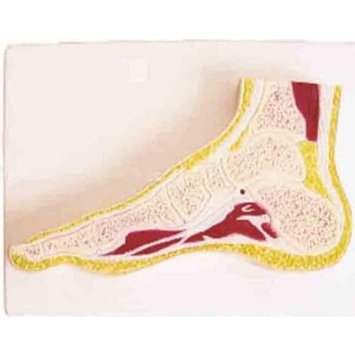 SMD02569 foot joint profile model