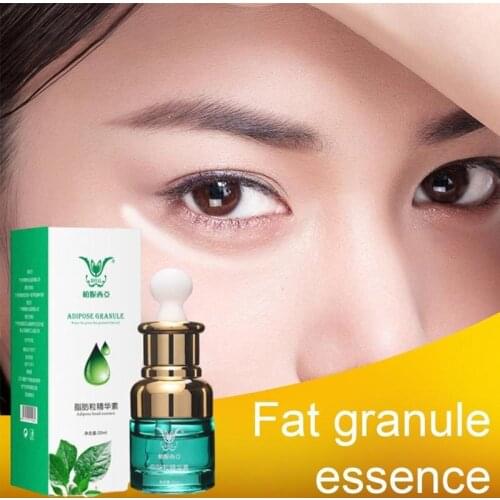 20ml Lighten dark circles in 7 days remove eye bags fat particles Eye Serum Anti-Wrinkle eye skin care cream Anti Puffiness