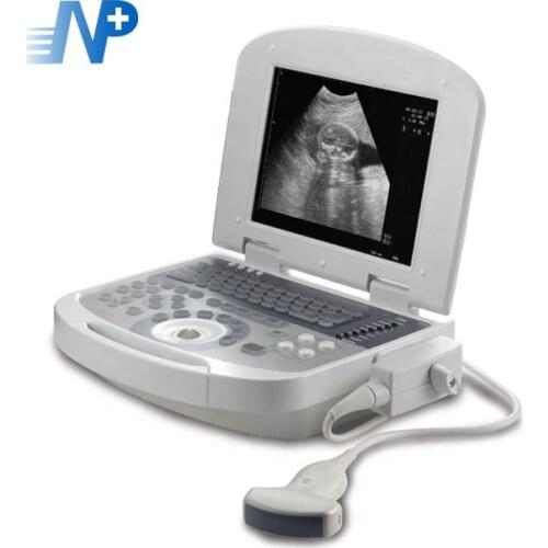 Cheapest High Quality Portable Ultrasound Machine Full Digital Black and White Ultrasound