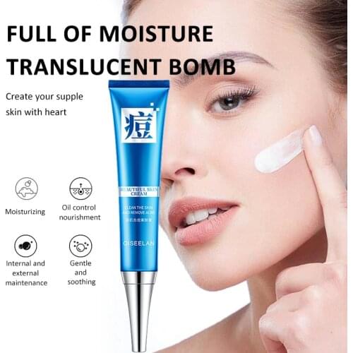 Replenishing Acne Cream Face Care Moisturizing Repair Fade Acne Marks Refreshing Oil Control Deep Cleaning Skin Care TSLM2