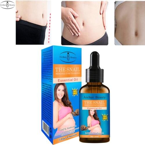 Aichun Beauty Stretch Mark Oils China