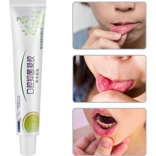 Mouth Ulcer Relief Gel Natural Herbal Oral Hygiene Bad Cream Pain Antibacterial Breath Irritation Inflammation Severe M6V3