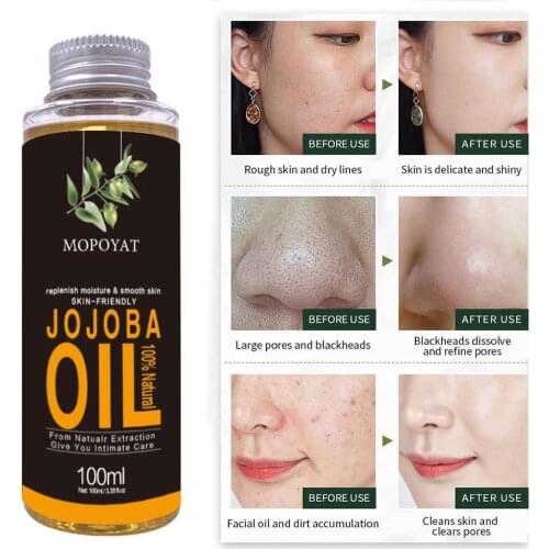 Pure Natural Aphrodisiac Organic Jojoba Oil Relaxing Oil Moisturizing Skin Oil Massage Essential Oil Oil Sleep 100ml Help P O2U4