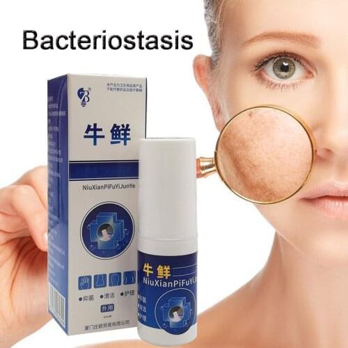 Psoriasis China Hmong Eczema Balm Inhibition Fungal infections Foot And Ringworm Actinic Dermatitis Acne Vulgaris Cream